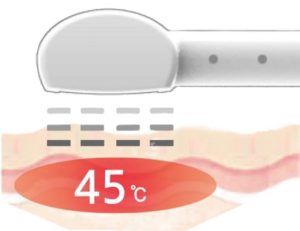 高濃度水玉リフティングで美しく輝くお肌へ。最新水玉リフティング
